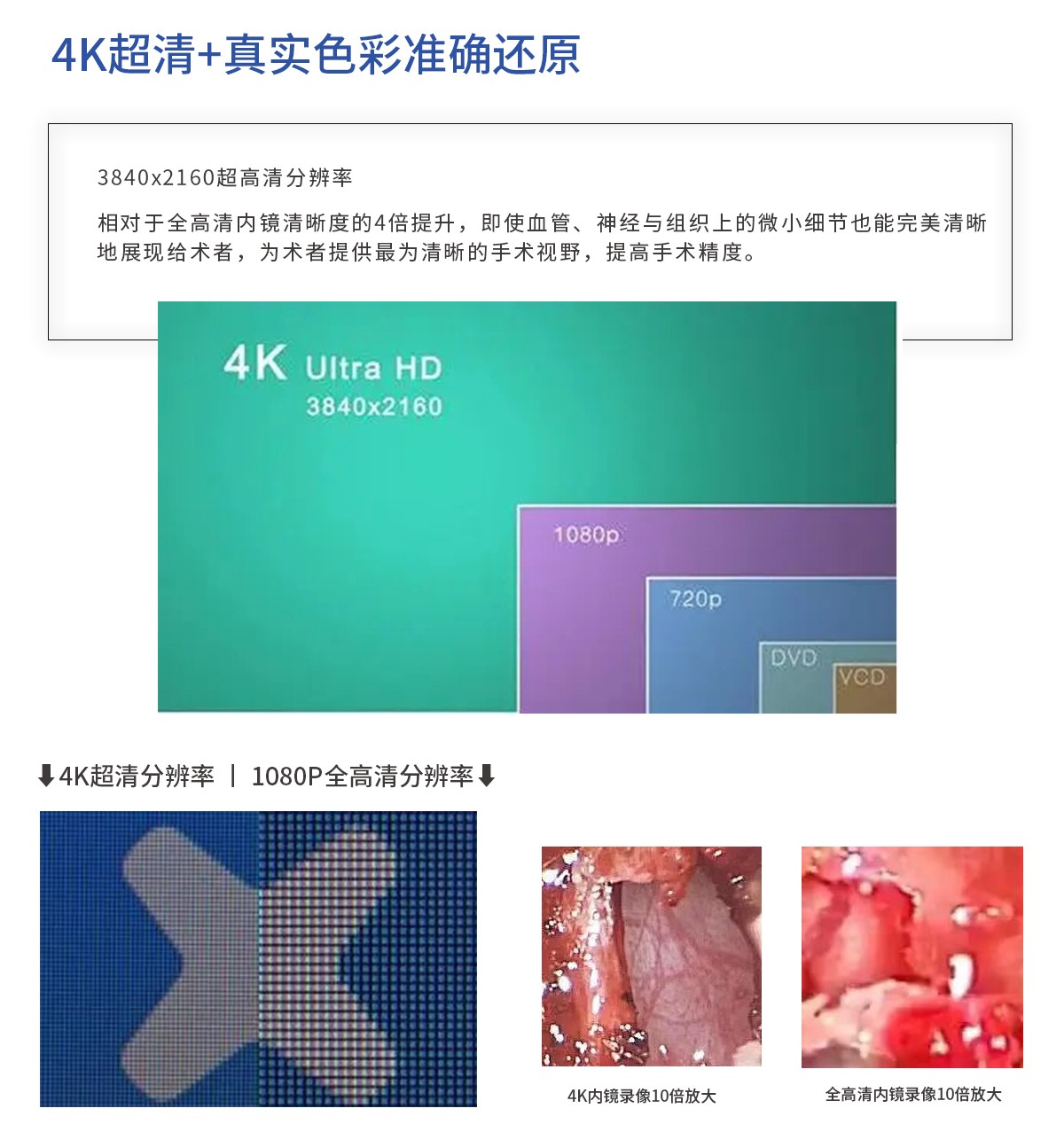 【4K醫用內窺鏡攝像系統】您的第一臺“4K”找到了嗎？