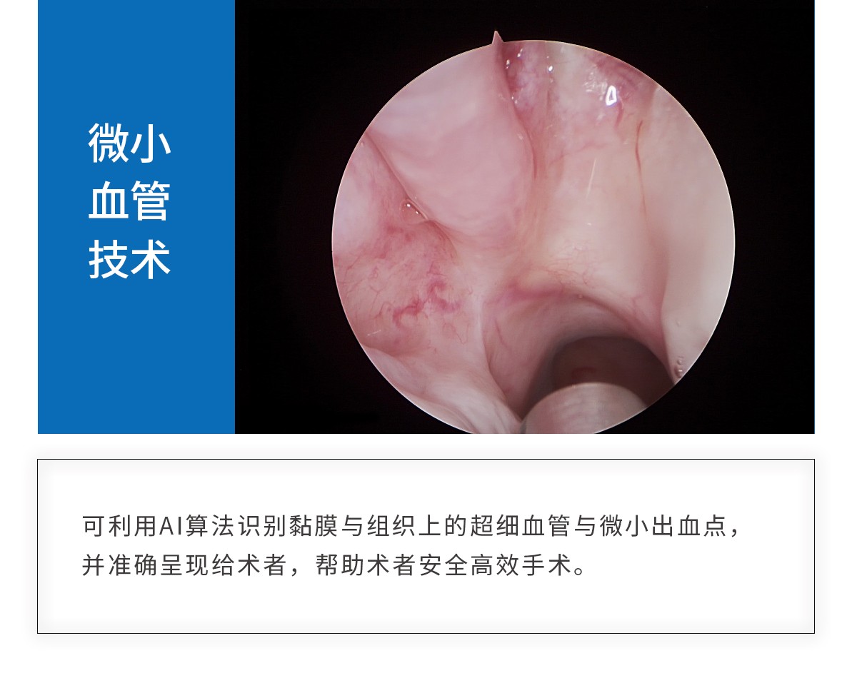 【4K醫用內窺鏡攝像系統】您的第一臺“4K”找到了嗎？