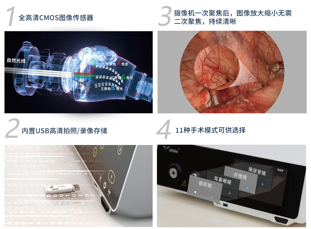 YKD-9102 一體化內窺鏡影像系統